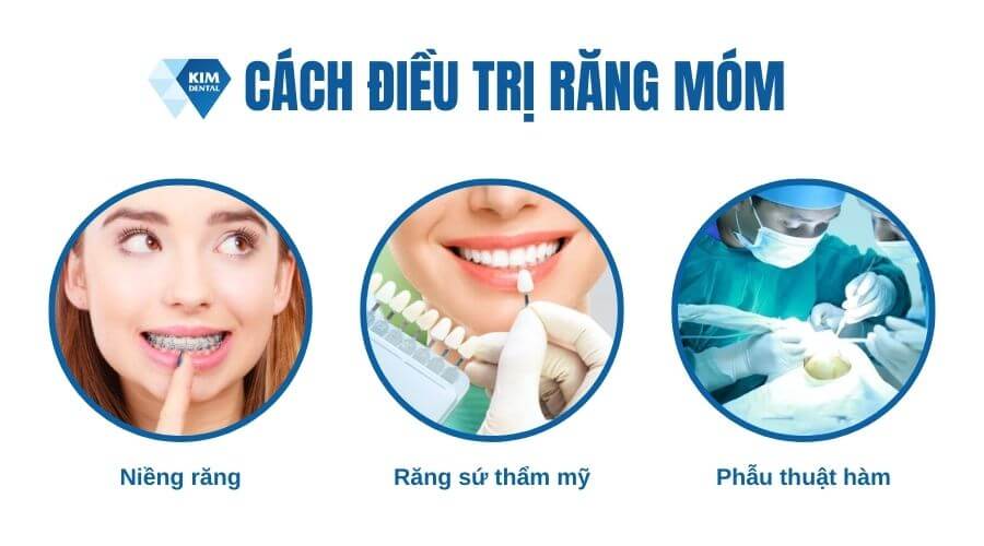 Cách điều trị răng bị móm an toàn, hiệu quả nhanh 