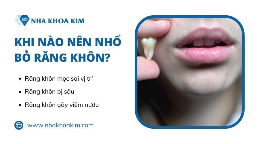 Khi nào nên nhổ bỏ răng khôn?