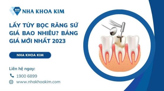 Lấy tủy bọc răng sứ giá bao nhiêu? Bảng giá mới nhất 2024