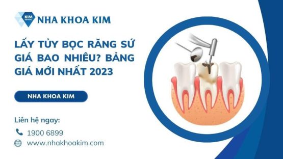 Lấy tủy bọc răng sứ giá bao nhiêu? Bảng giá mới nhất 2024