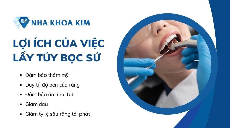 Răng lấy tủy có nên bọc lại?