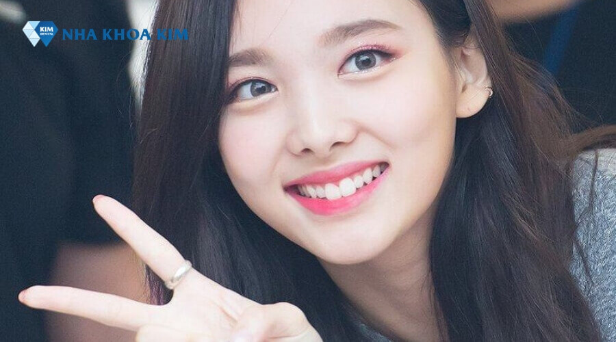 Hình ảnh răng thỏ của Nayeon