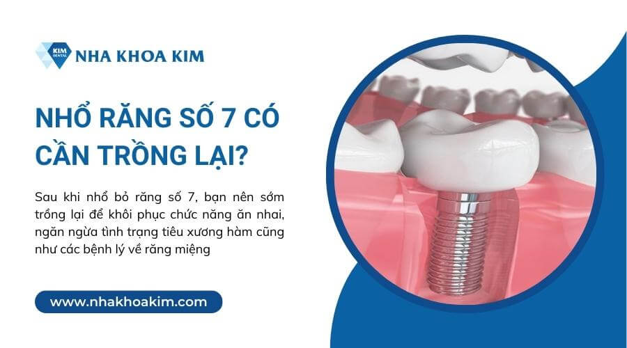 Nhổ răng số 7 có cần trồng lại?