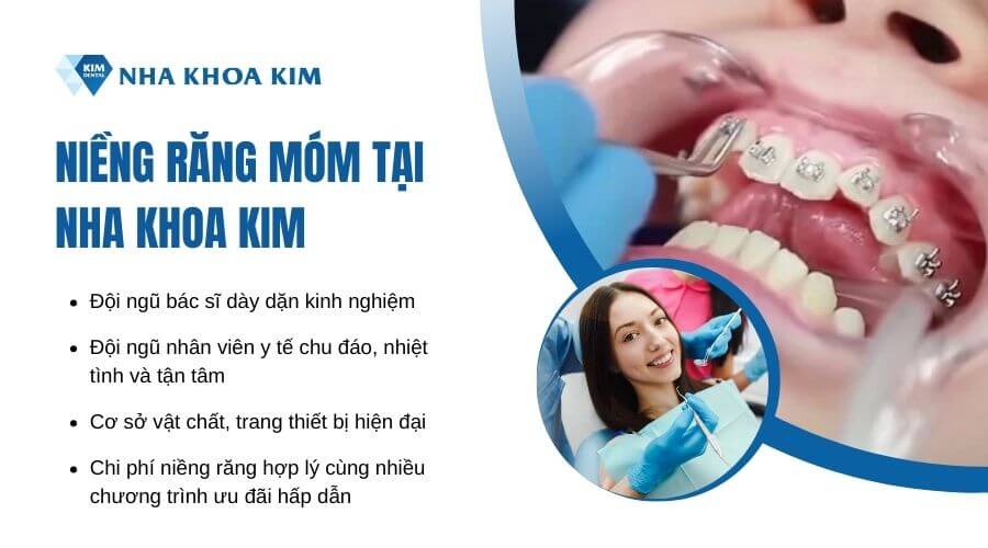 Niềng răng móm tại Nha Khoa Kim