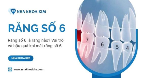Răng số 6 là răng nào? Vai trò và hậu quả khi mất răng số 6