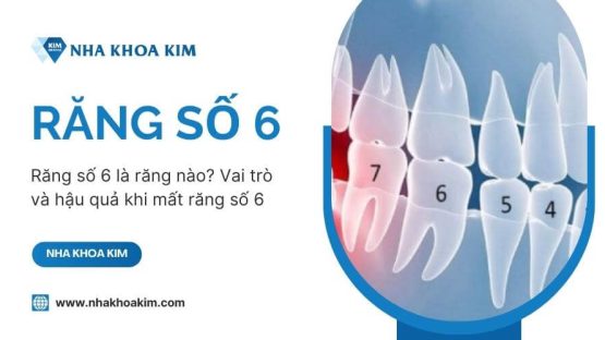 Răng số 6 là răng nào? Vai trò và hậu quả khi mất răng số 6
