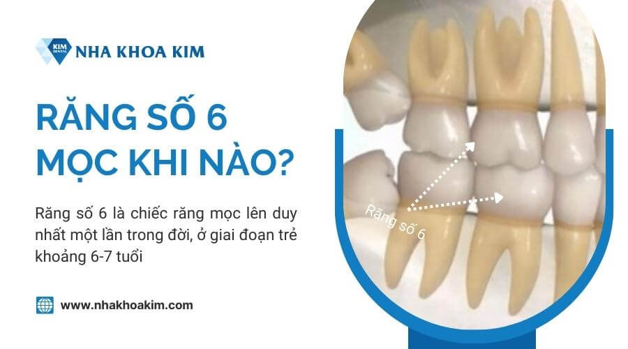 Răng số 6 mọc khi nào?