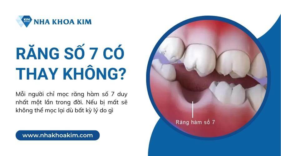 Răng số 7 có thay không?