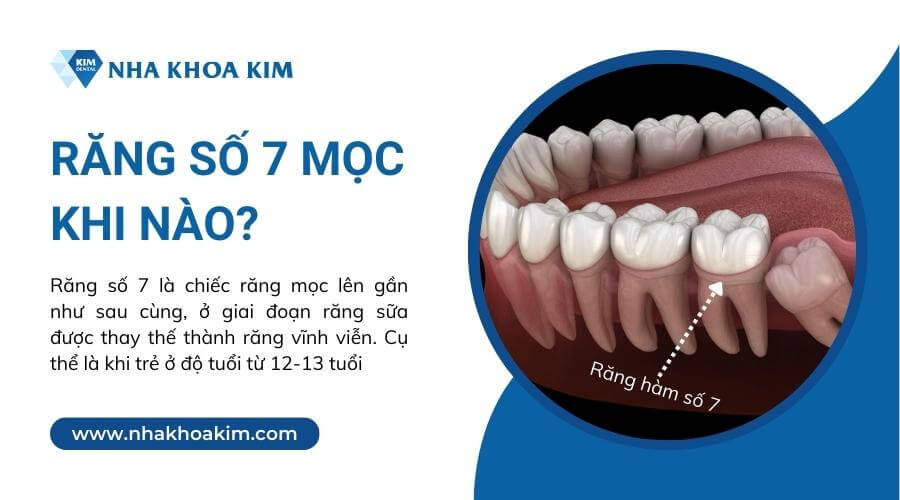 Răng số 7 mọc khi nào?