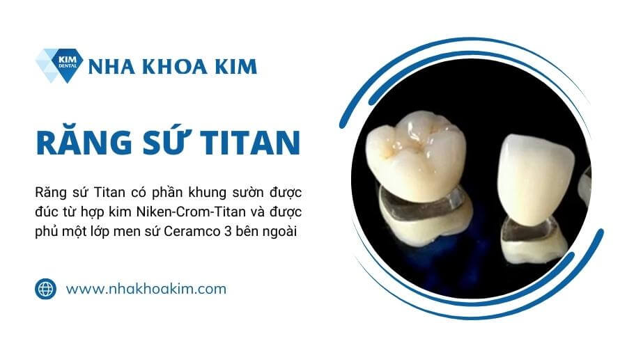 Răng sứ Titan