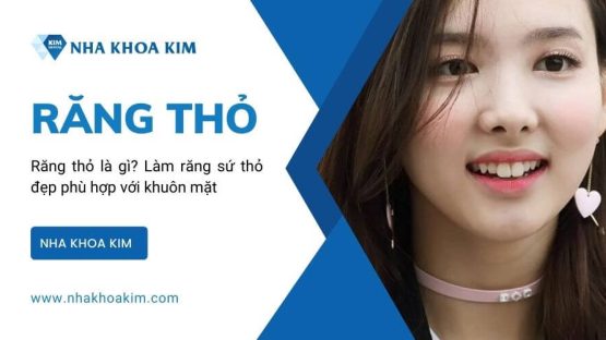 Răng thỏ là gì? Làm răng sứ thỏ đẹp phù hợp với khuôn mặt