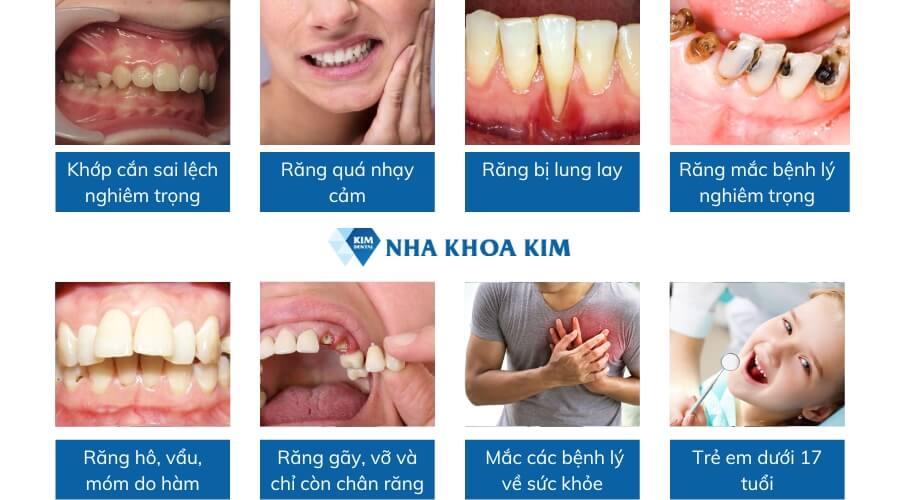 08 Trường hợp không nên bọc răng sứ thẩm mỹ