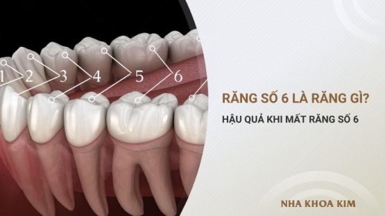 Răng số 6 là răng nào? Vai trò và hậu quả khi mất răng số 6