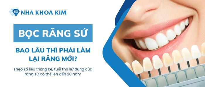 Bọc răng sứ bao lâu thì phải làm lại răng mới?