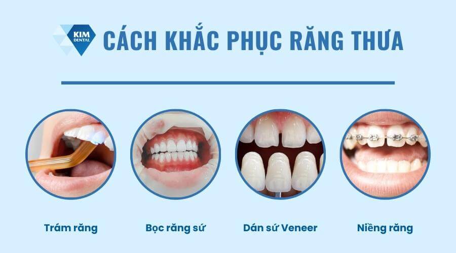 Răng thưa nên làm gì?