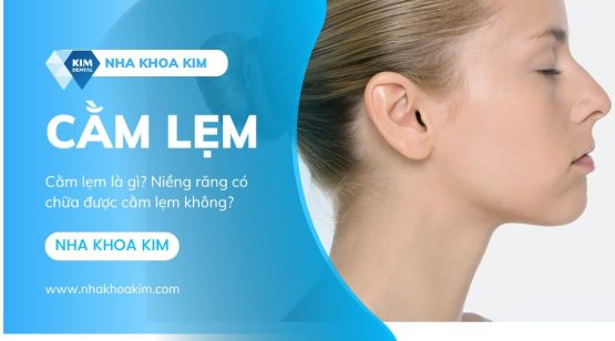 Cằm lẹm là gì? Căm lẹm niềng răng có hết không?