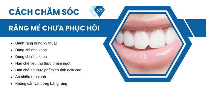Cách chăm sóc răng mẻ khi chưa phục hồi