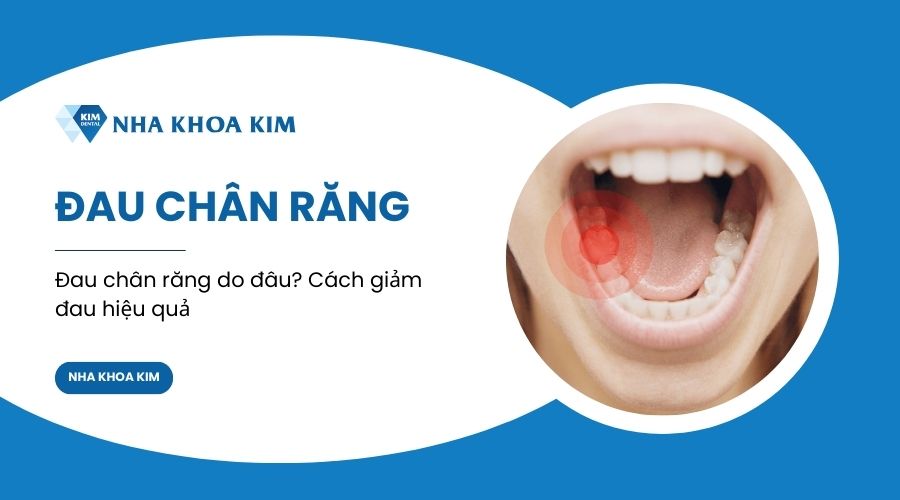 Đau Chân Răng: Nguyên Nhân, Biện Pháp Phòng Ngừa và Điều Trị Hiệu Quả