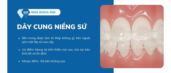 Dây cung niềng sứ