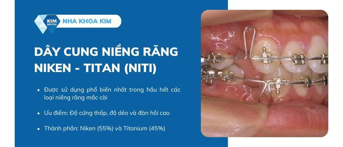 Dây cung Niken - Titan (Niti)