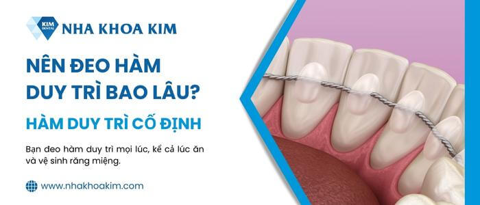 Thời gian đeo hàm duy trì cố định