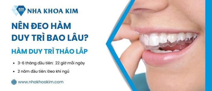 Thời gian đeo hàm duy trì tháo lắp