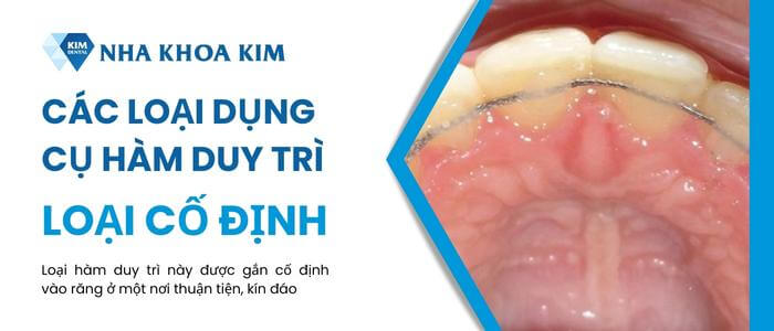 Hàm duy trì cố định