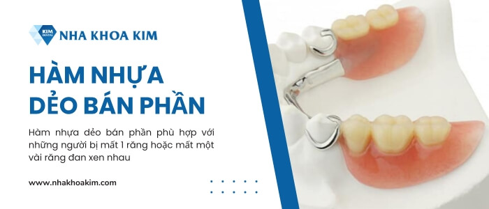 Hàm nhựa dẻo bán phần