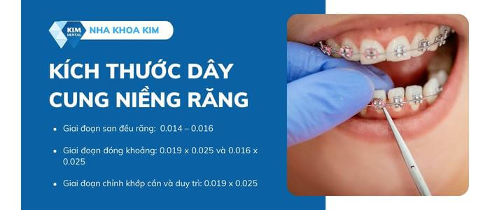 Kích thước của dây cung niềng răng