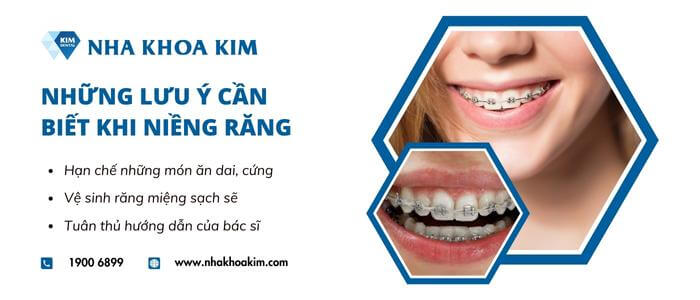Lưu ý trong và sau khi niềng răng