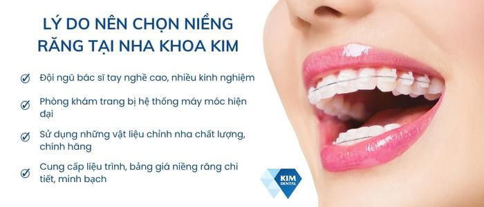 Cách tối ưu chi phí niềng răng