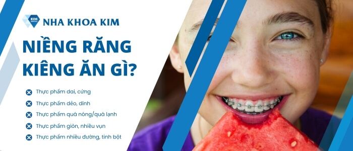 Niềng răng kiêng ăn gì?
