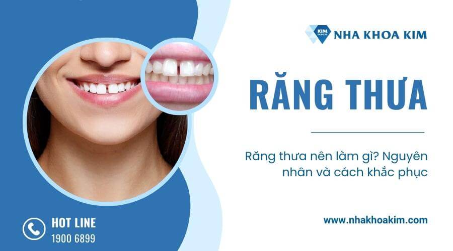 Vì sao răng thưa? Nguyên nhân và cách khắc phục