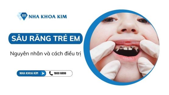 Sâu răng trẻ em: Nguyên nhân và cách điều trị