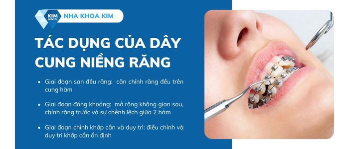 Tác dụng của dây cung trong niềng răng