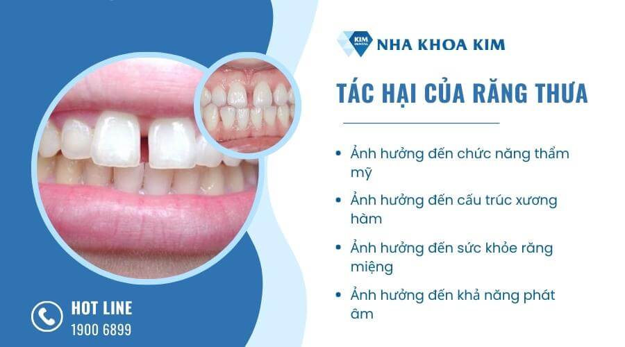 Tác hại của răng thưa