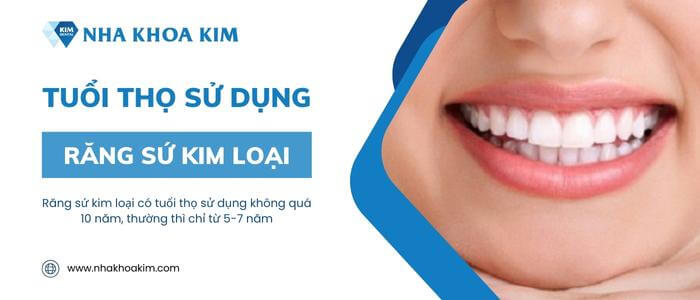 Tuổi thọ sử dụng của răng sứ kim loại