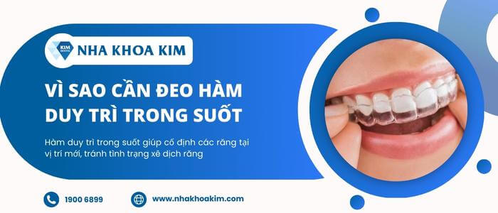 Tại sao phải đeo hàm duy trì trong suốt sau niềng răng?