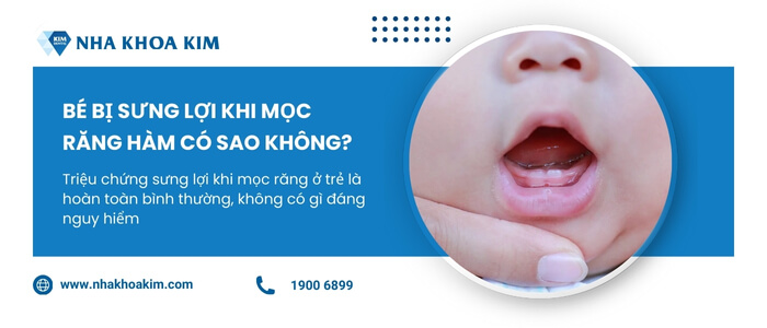 Bé bị sưng lợi khi mọc răng hàm có sao không?