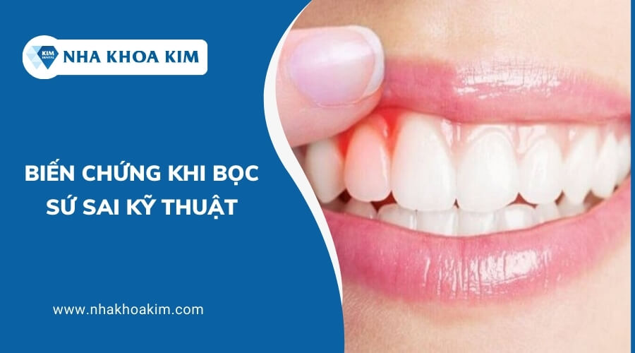 Biến chứng khi bọc sứ sai kỹ thuật