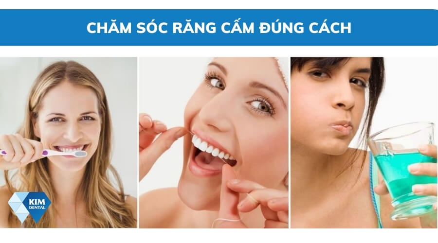 Cách vệ sinh răng cấm đúng cách
