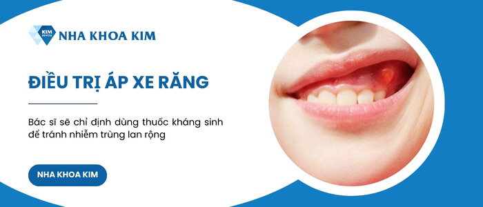 Điều trị áp xe giảm đau chân răng