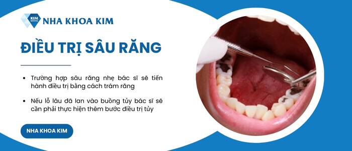 Điều trị đau chân răng tại nha khoa