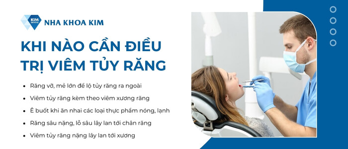 Khi nào cần điều trị viêm tủy răng