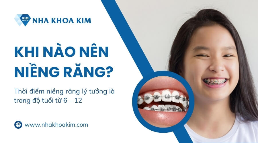 Khi nào nên niềng răng