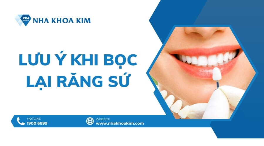 Lưu ý khi bọc lại răng sứ sau tháo