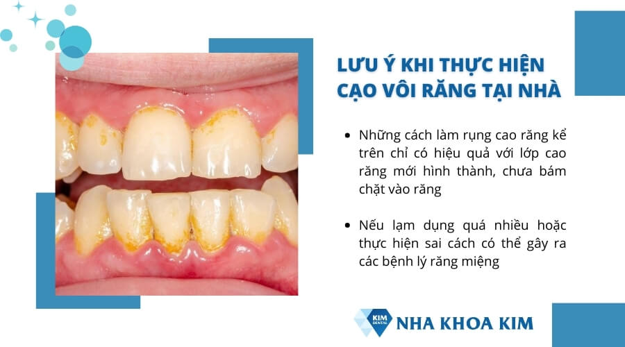 Lưu ý nên biết khi thực hiện cạo vôi răng tại nhà