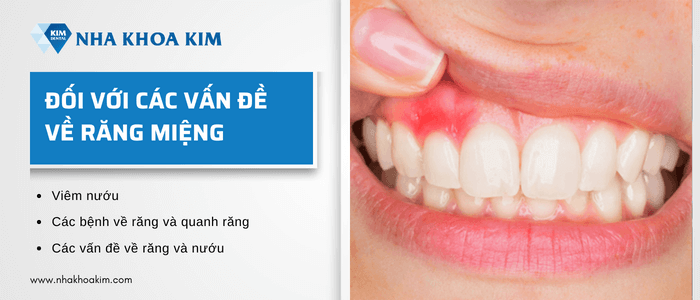 Tại sao khi đánh răng hay bị chảy máu?