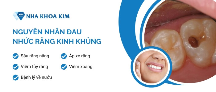 Nguyên nhân gây đau nhức răng kinh khủng