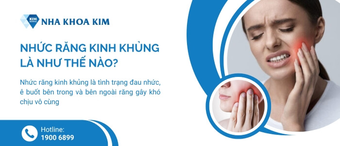 Nhức răng kinh khủng là như thế nào?